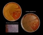 Avirulent pneumococci and Viridans streptococci
